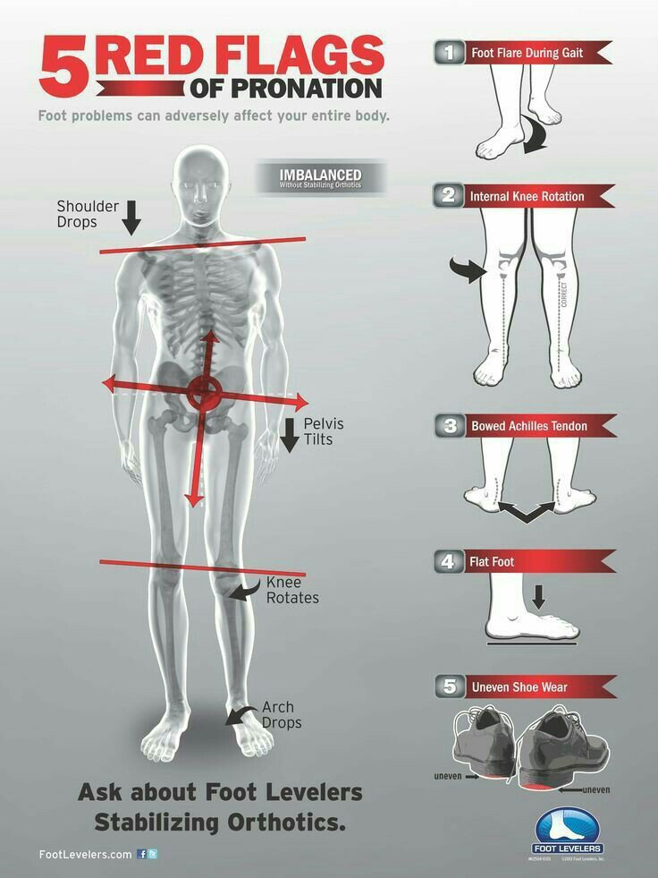 Illustration on how the feet affects the entire body posture