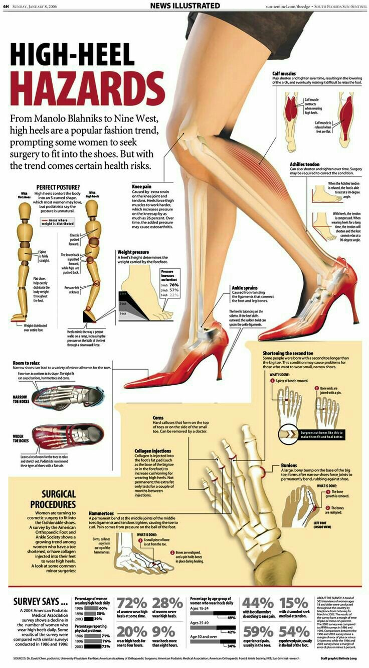 Infographics on how heels affects posture and health